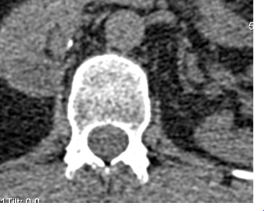 CT spine I think